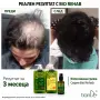 Шампоан за растеж, снимка 2