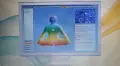 Биорезонансен диагностичен апарат НОВА ТИП II, снимка 5