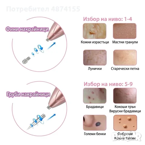 Уред за премахване на бенки , снимка 4 - Козметични уреди - 56634022